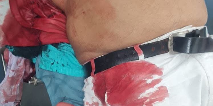 सिवान में अंधाधुंध फायरिंग, पूर्व जिला पार्षद के भाई को गोलियों से भूना –