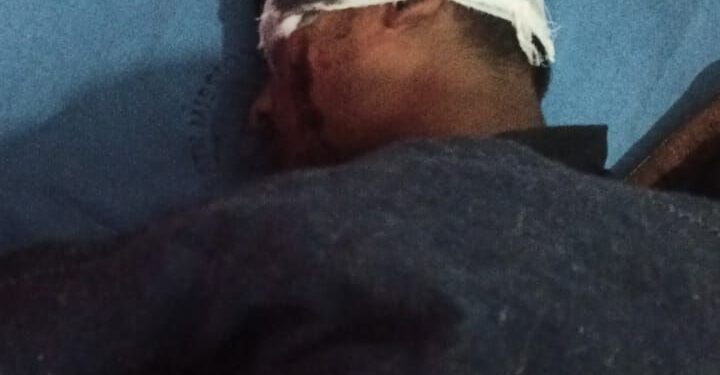 शराब के नशे में पिकअप चालक की लापरवाही, गांव में हंगामा—ग्रामीणों ने वाहन पकड़कर पुलिस को सौंपा