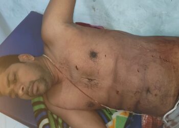 कूड़ा फेंकने के विवाद में खूनी संघर्ष, चाकूबाजी में पिता-पुत्र जख्मी, गोरखपुर रेफर