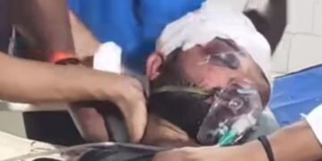 गोपालगंज: ज्वेलरी दुकान लूटकांड के आरोपी कुख्यात अपराधी गोलू मिश्रा की इलाज के दौरान मौत।