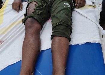धान रोपनी के दौरान गिरी आकाशीय बिजली, किसान की दर्दनाक मौत; दूसरा युवक गंभीर रूप से घायल