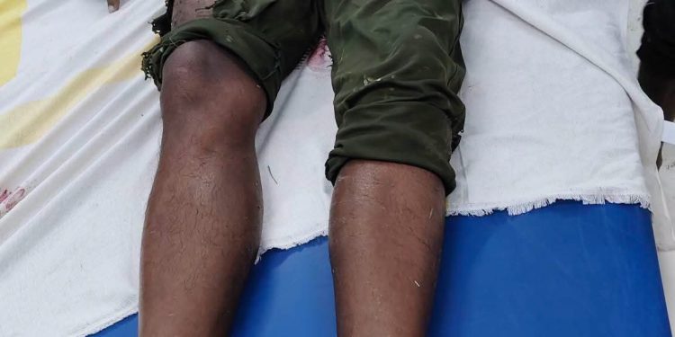 धान रोपनी के दौरान गिरी आकाशीय बिजली, किसान की दर्दनाक मौत; दूसरा युवक गंभीर रूप से घायल