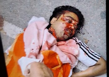 सोने की चेन लूटने के दौरान धारदार हथियार से वार, विजय की मौत; पिता के आवेदन पर प्राथमिकी